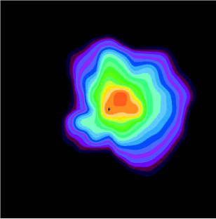 PPD-PPG Asymétrique